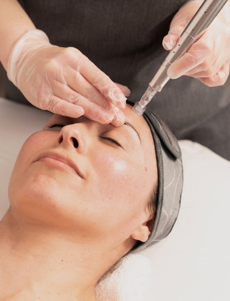 Kosmetikstudio Leipzig Micro Needling