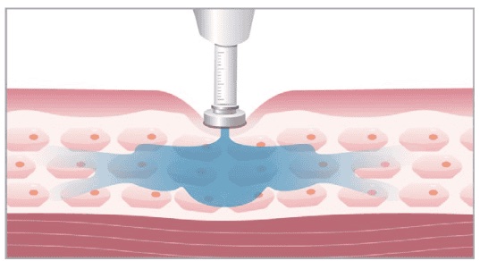 Syna Plus Gesichstbehandlung