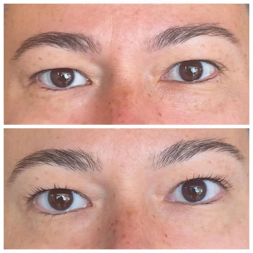 Wimpernlifting Bei Schlupflid