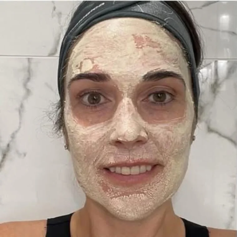Die MelanoPro Peeling Maske während der Einwirkzeit im Gesicht